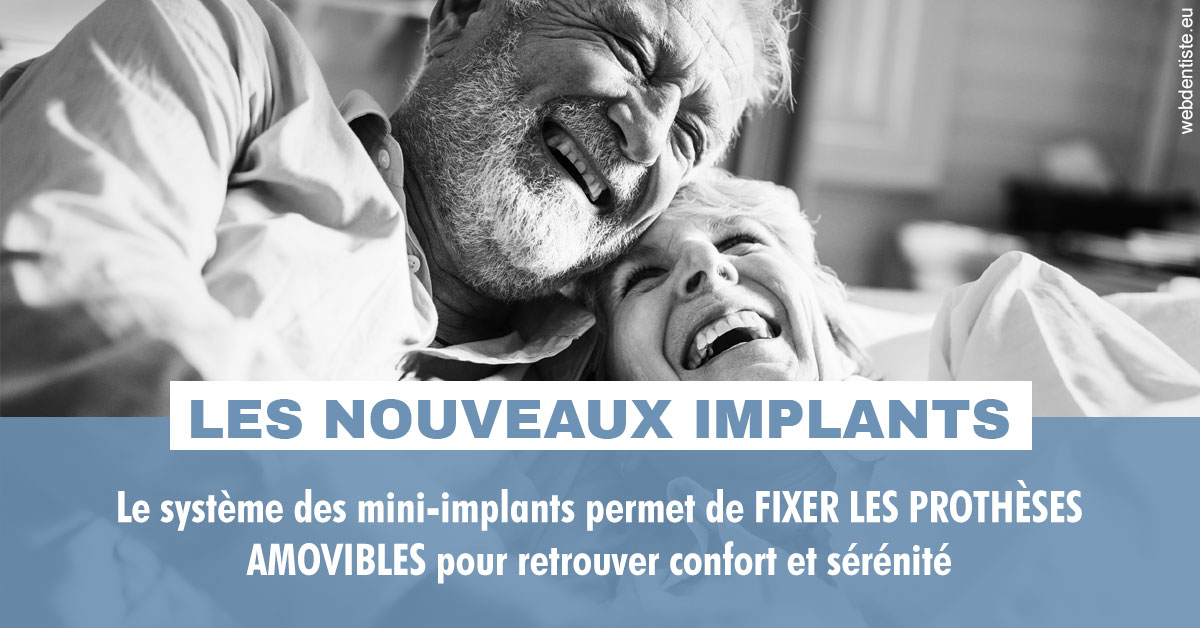 https://www.dentistes-saint-jean-centre.com/Les nouveaux implants 2
