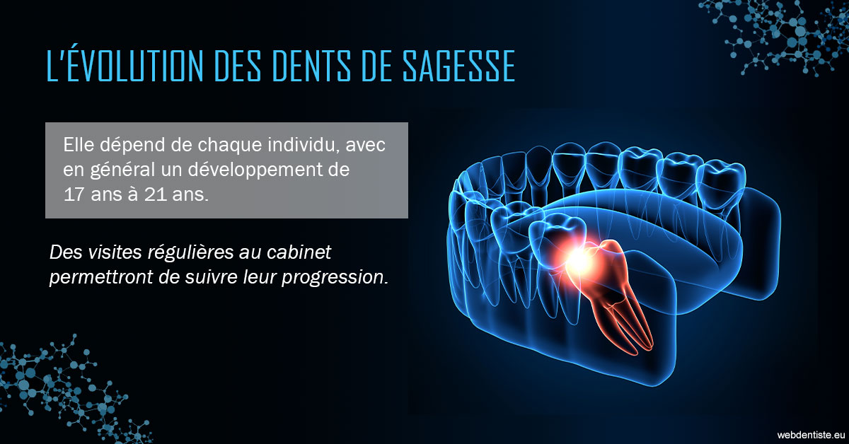 https://www.dentistes-saint-jean-centre.com/2023 T4 - Dents de sagesse 01