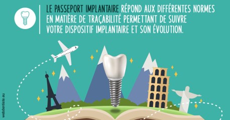 https://www.dentistes-saint-jean-centre.com/Le passeport implantaire