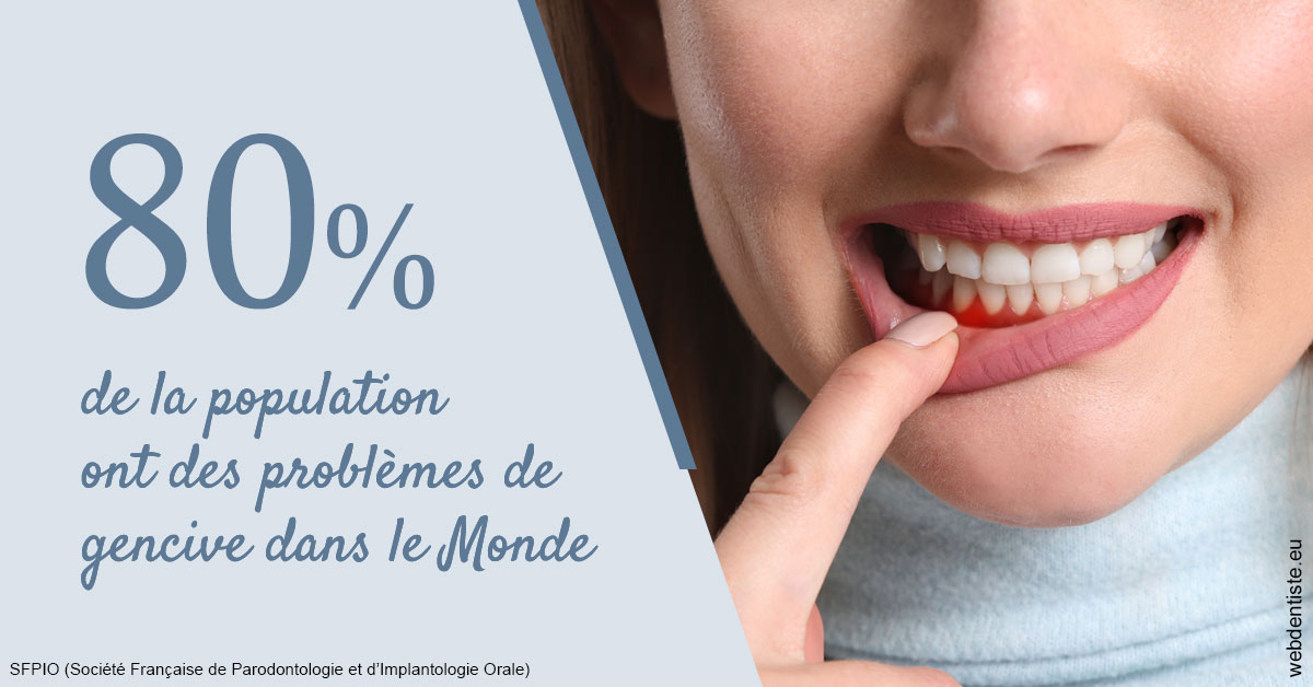 https://www.dentistes-saint-jean-centre.com/Problèmes de gencive 2