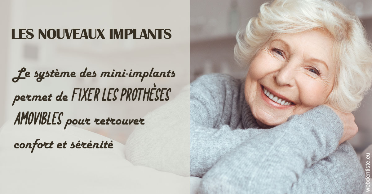 https://www.dentistes-saint-jean-centre.com/Les nouveaux implants 1