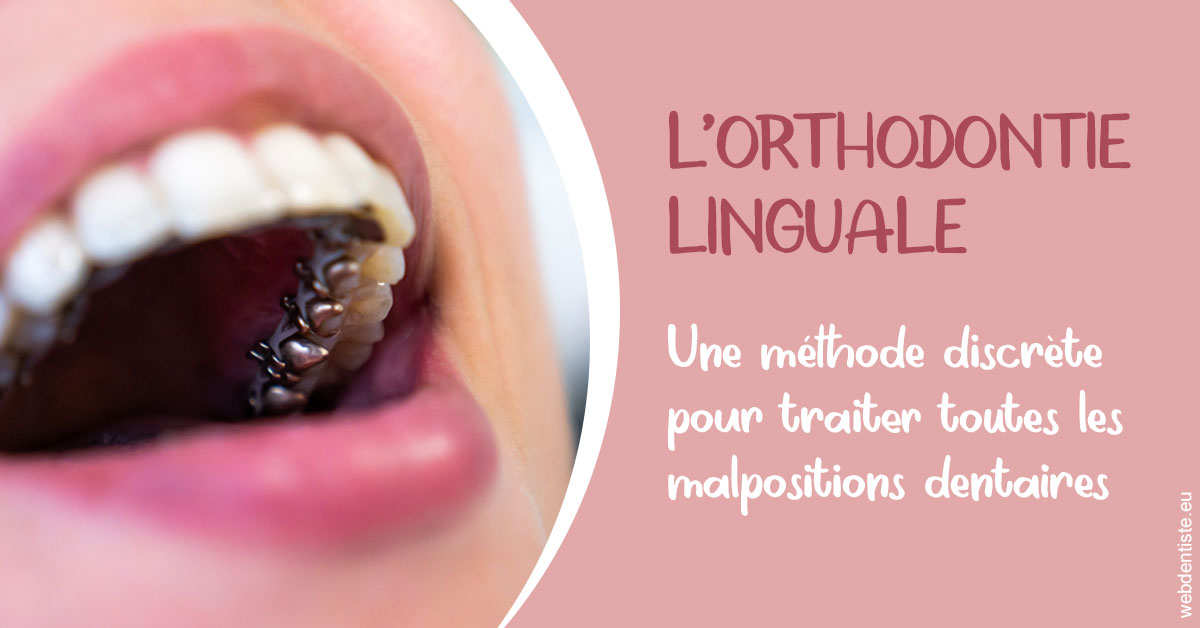 https://www.dentistes-saint-jean-centre.com/L'orthodontie linguale 2