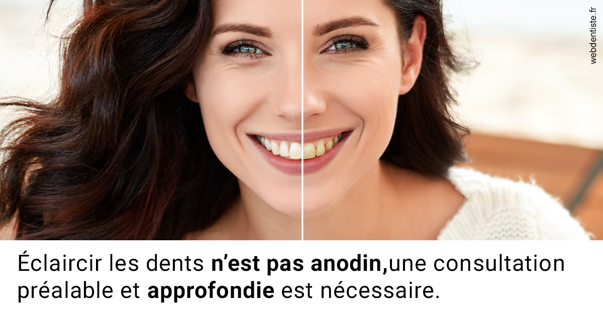 https://www.dentistes-saint-jean-centre.com/Le blanchiment 2