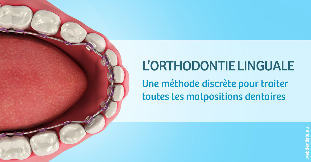 https://www.dentistes-saint-jean-centre.com/L'orthodontie linguale 1