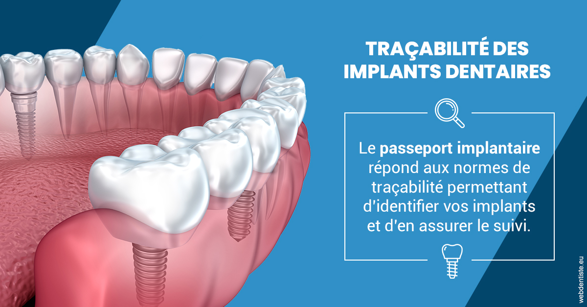 https://www.dentistes-saint-jean-centre.com/T2 2023 - Traçabilité des implants 1