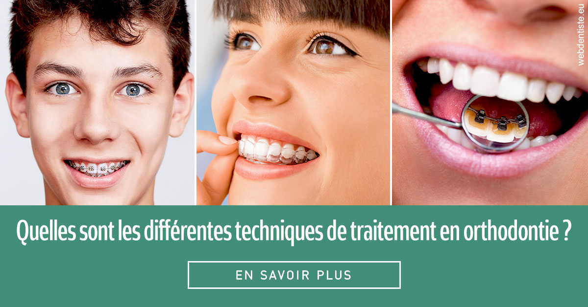 https://www.dentistes-saint-jean-centre.com/Les différentes techniques de traitement 2