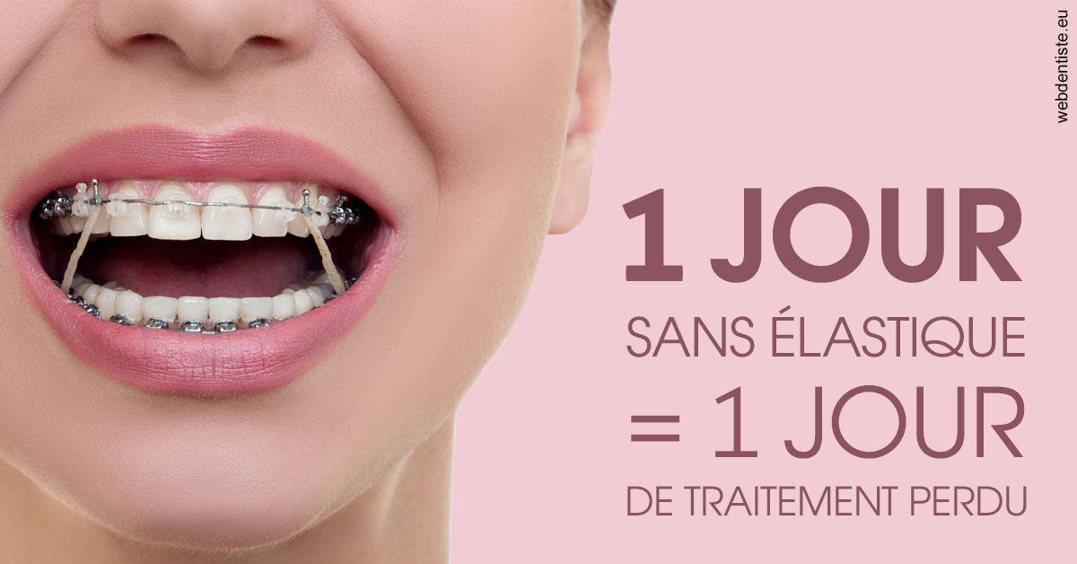 https://www.dentistes-saint-jean-centre.com/Elastiques 2