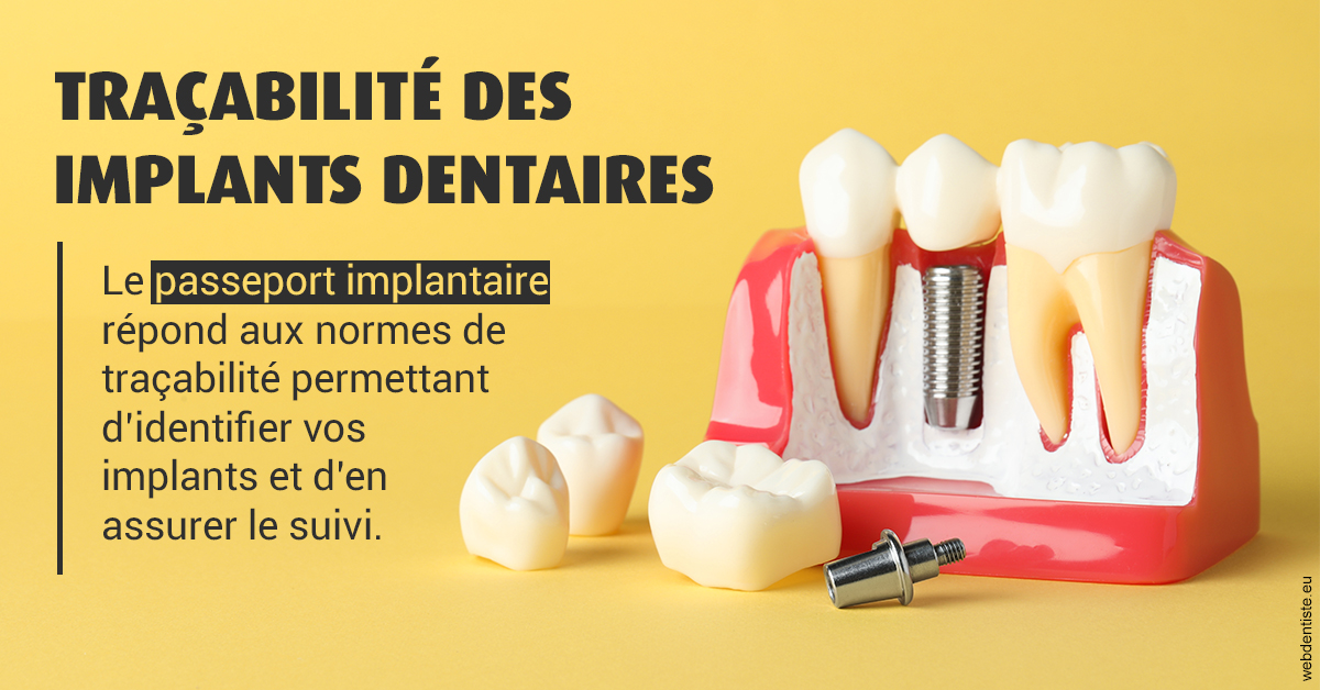 https://www.dentistes-saint-jean-centre.com/T2 2023 - Traçabilité des implants 2