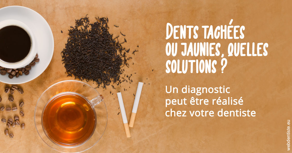 https://www.dentistes-saint-jean-centre.com/Dents tachées 2