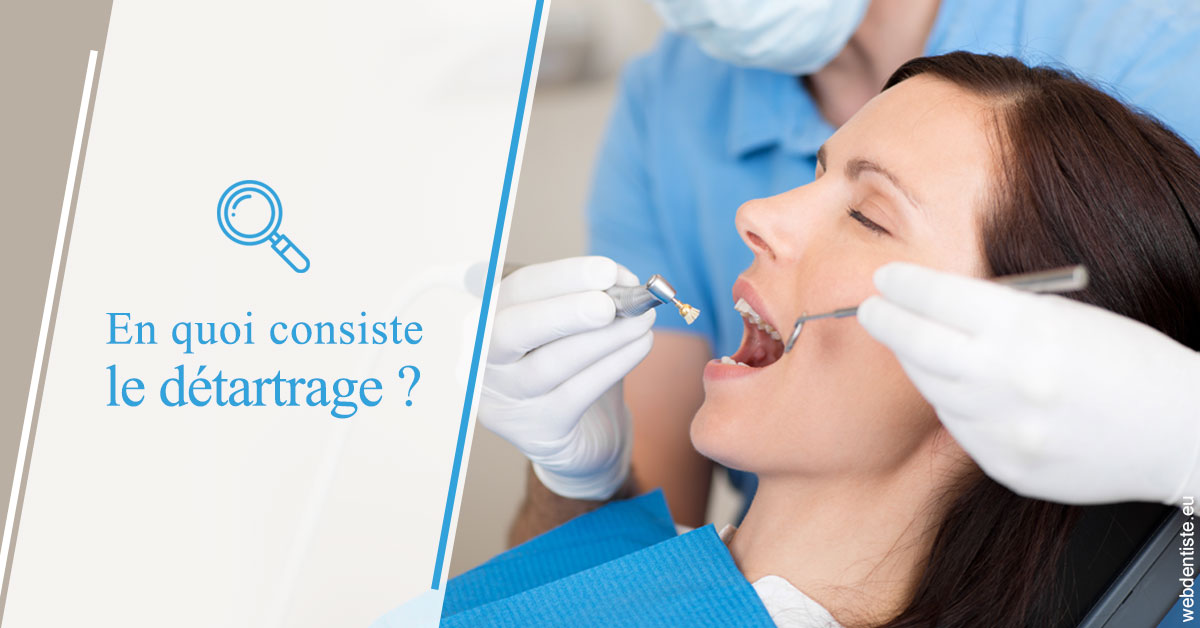 https://www.dentistes-saint-jean-centre.com/En quoi consiste le détartrage