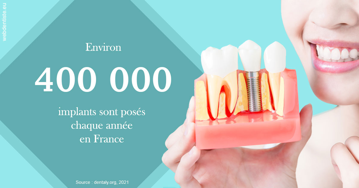 https://www.dentistes-saint-jean-centre.com/Pose d'implants en France 2