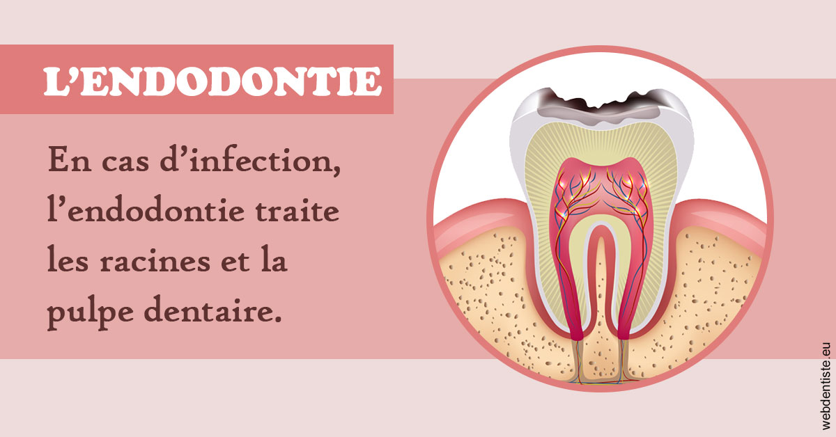 https://www.dentistes-saint-jean-centre.com/L'endodontie 2