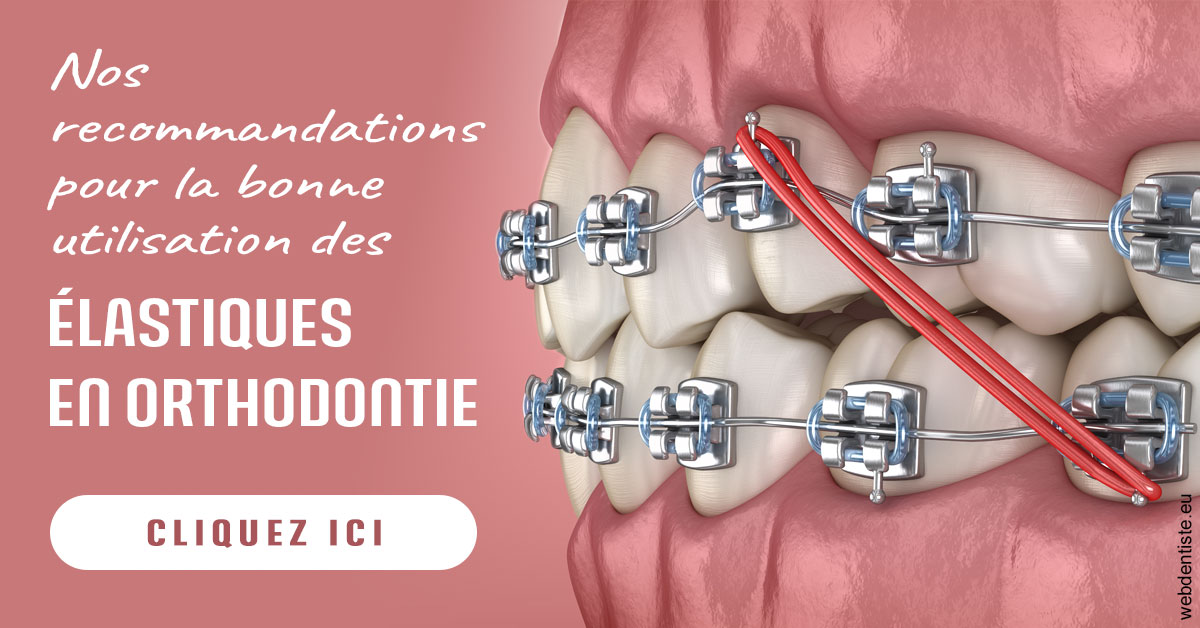 https://www.dentistes-saint-jean-centre.com/Elastiques orthodontie 2
