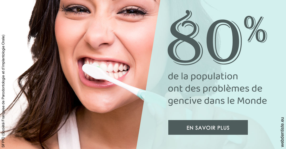 https://www.dentistes-saint-jean-centre.com/Problèmes de gencive 1
