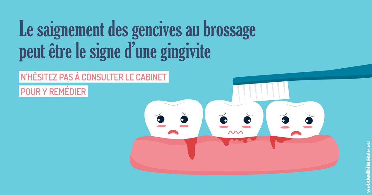 https://www.dentistes-saint-jean-centre.com/2023 T4 - Saignement des gencives 02